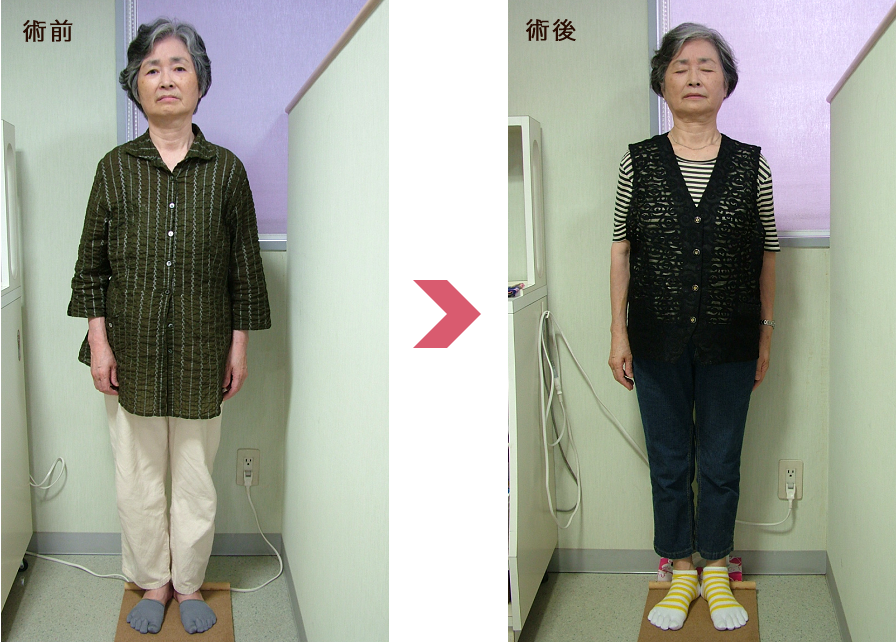 術前は元気が無いような立ち方ですが、術後はバランスもとれて、ピシッと姿勢よく立っています。