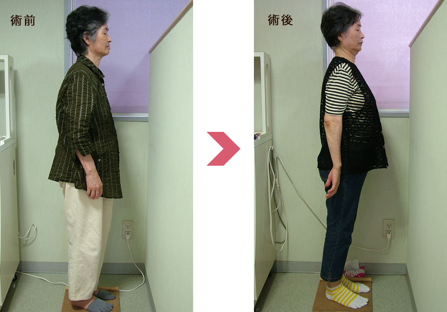 背筋が伸びて若々しく立っています。
